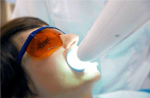 Understanding the Causes of Teeth Sensitivity Macclesfield