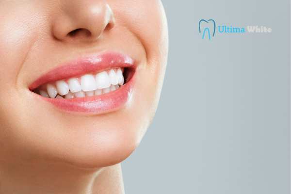Common Mistakes That Can Ruin Your Whitening Results Macclesfield