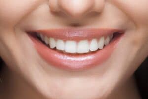 Your Diet Macclesfield Influences Teeth Whitening Maintenance