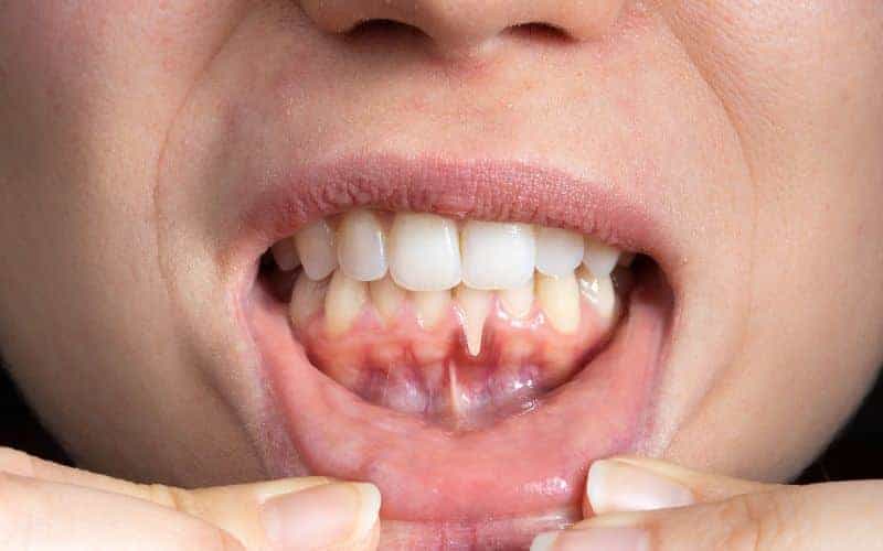Final Thoughts: Building Lifelong Enamel Protection Habits Macclesfield