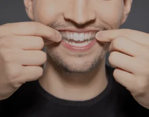 Overview of Home Teeth Whitening Kits Macclesfield