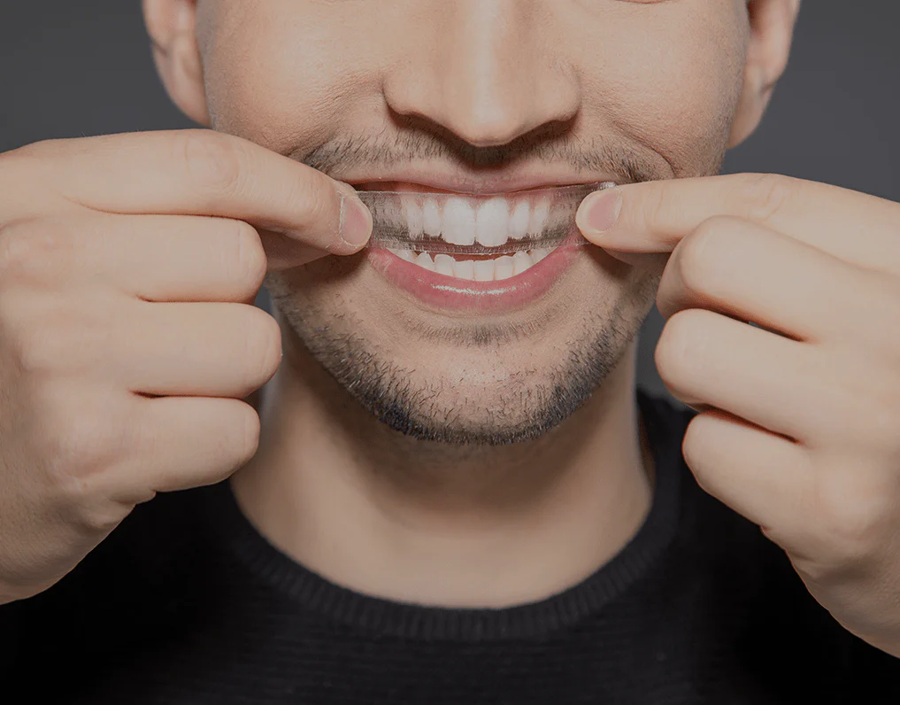 Can You Whiten Natural Teeth Without Harsh Chemicals Macclesfield?