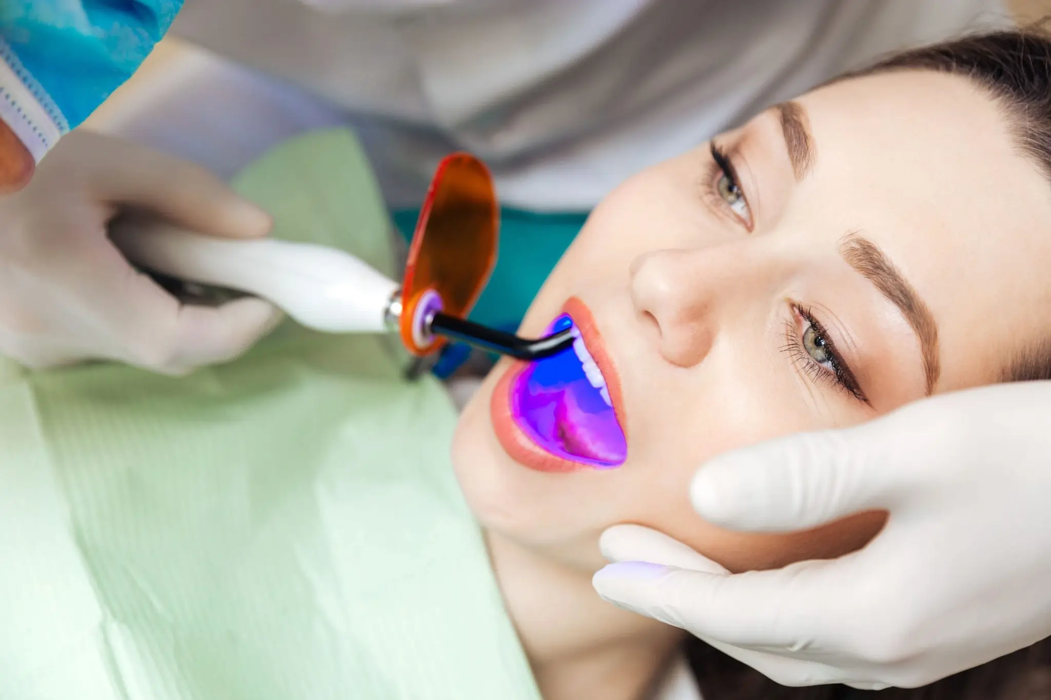 How Long Can You Expect Laser Teeth Whitening Results to Last Macclesfield?