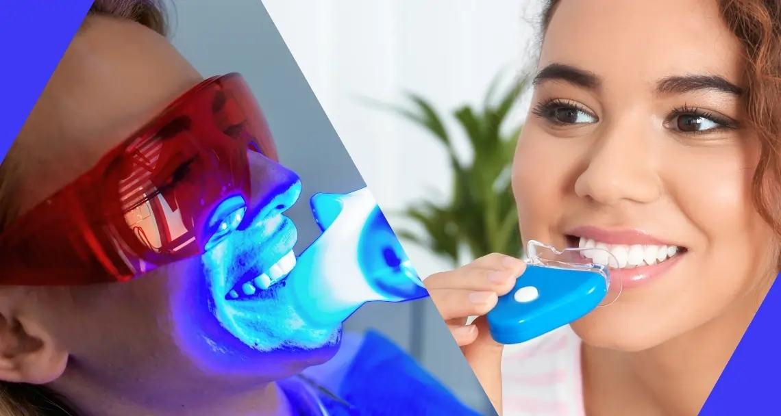 Expert Tips for Safe and Effective Whitening Macclesfield