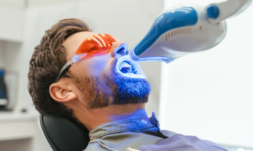 How Does Laser Teeth Whitening Actually Work Macclesfield?