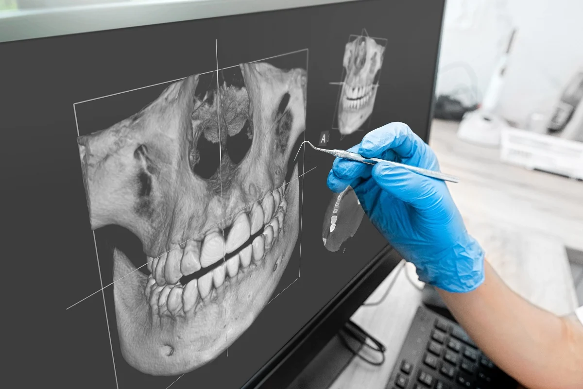 How Is AI Transforming Dental Treatment Planning Macclesfield?