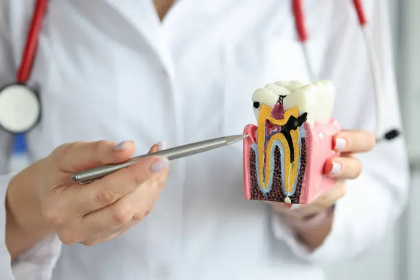Which Whitening Methods Are Gentler on Sensitive Teeth Macclesfield?