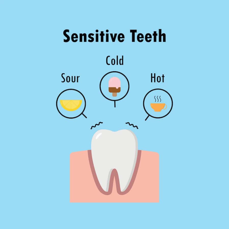 Why Do Teeth Become Sensitive After Whitening Treatments Macclesfield?