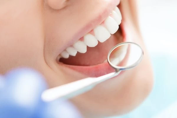How to Maintain Your Whiter Smile After Treatment Macclesfield