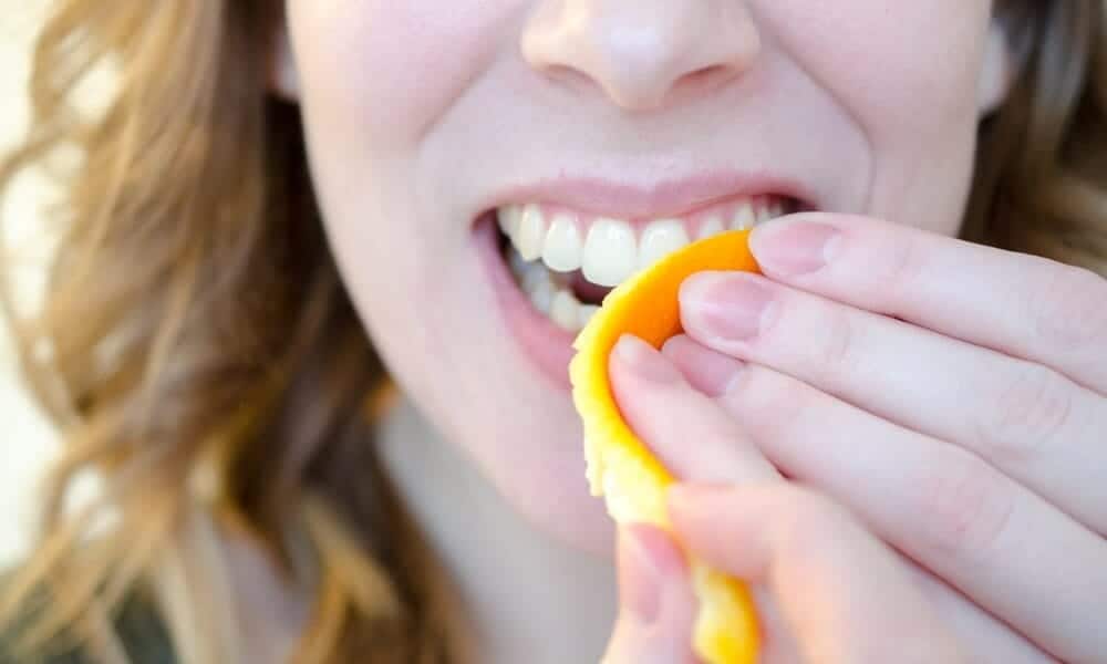 Professional vs DIY Teeth Whitening: What Works Best for Your Smile?