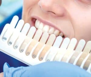 Ultimate Guide to Teeth Whitening with Natural Ingredients Macclesfield