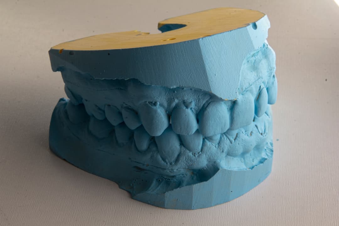 How Do Dental Implants Improve Jawbone Health and Oral Function Macclesfield?