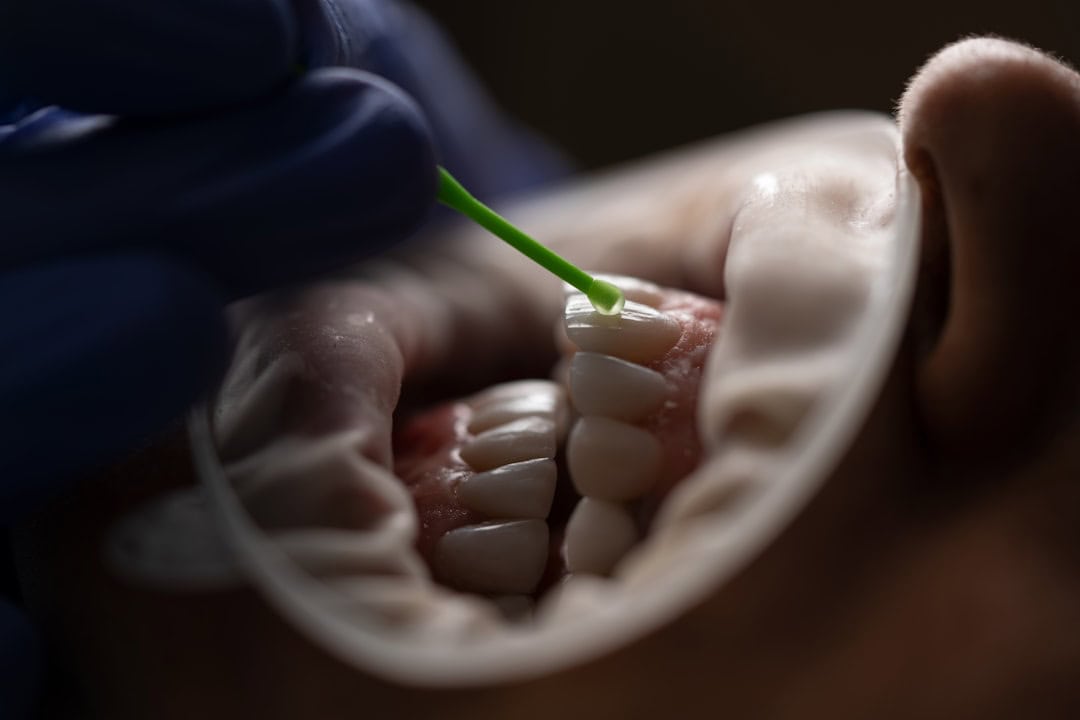 Common Causes of Persistent Dry Mouth Macclesfield