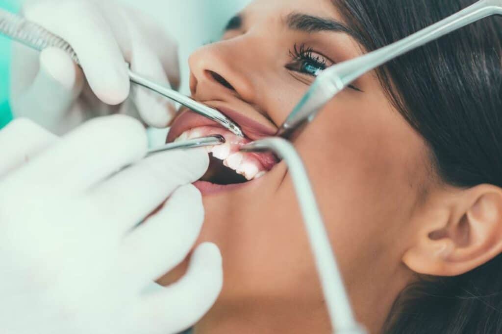 Braces Are Just for Kids – Myth or Reality Macclesfield