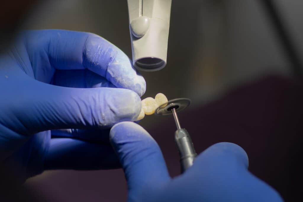 Customised Dental Solutions: Crowns, Aligners, and Implants Macclesfield
